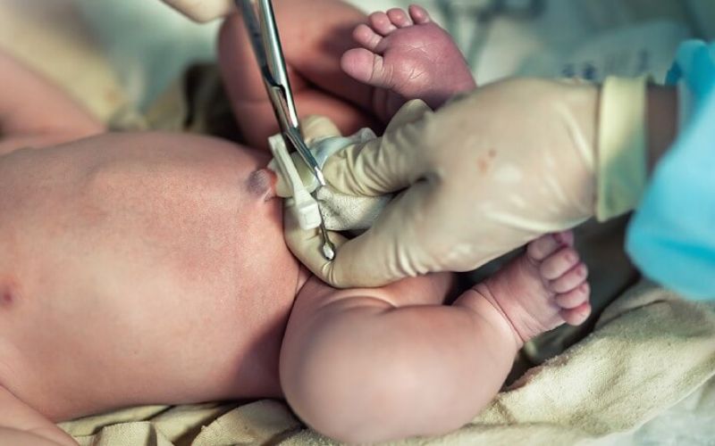 Tế bào gốc màng cuống rốn là một giải pháp thay thế tế bào gốc phôi đầy hứa hẹn